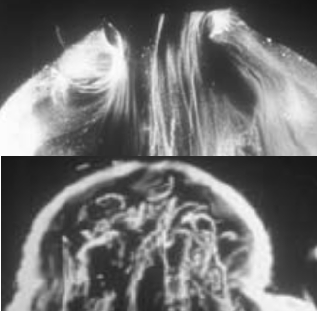 A black and white composite image of wispy light streaks above what appears to be a medical scan.