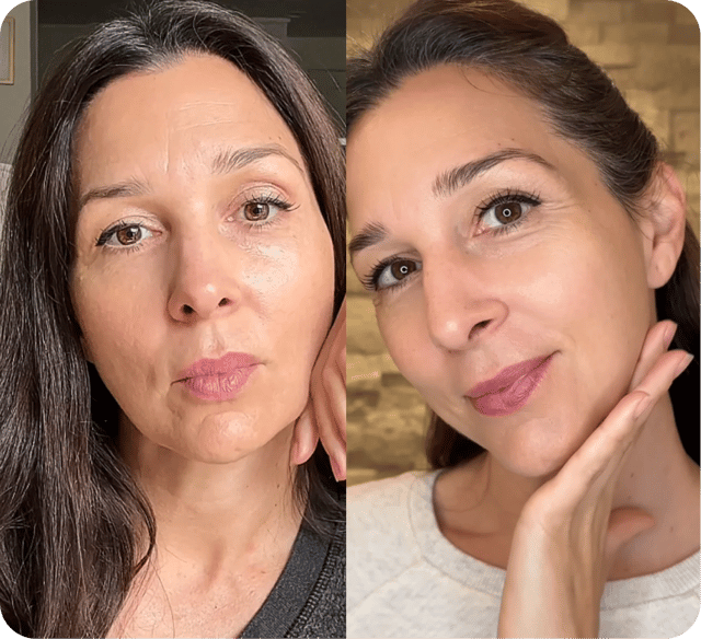 Dos mujeres con la piel suave y luminosa