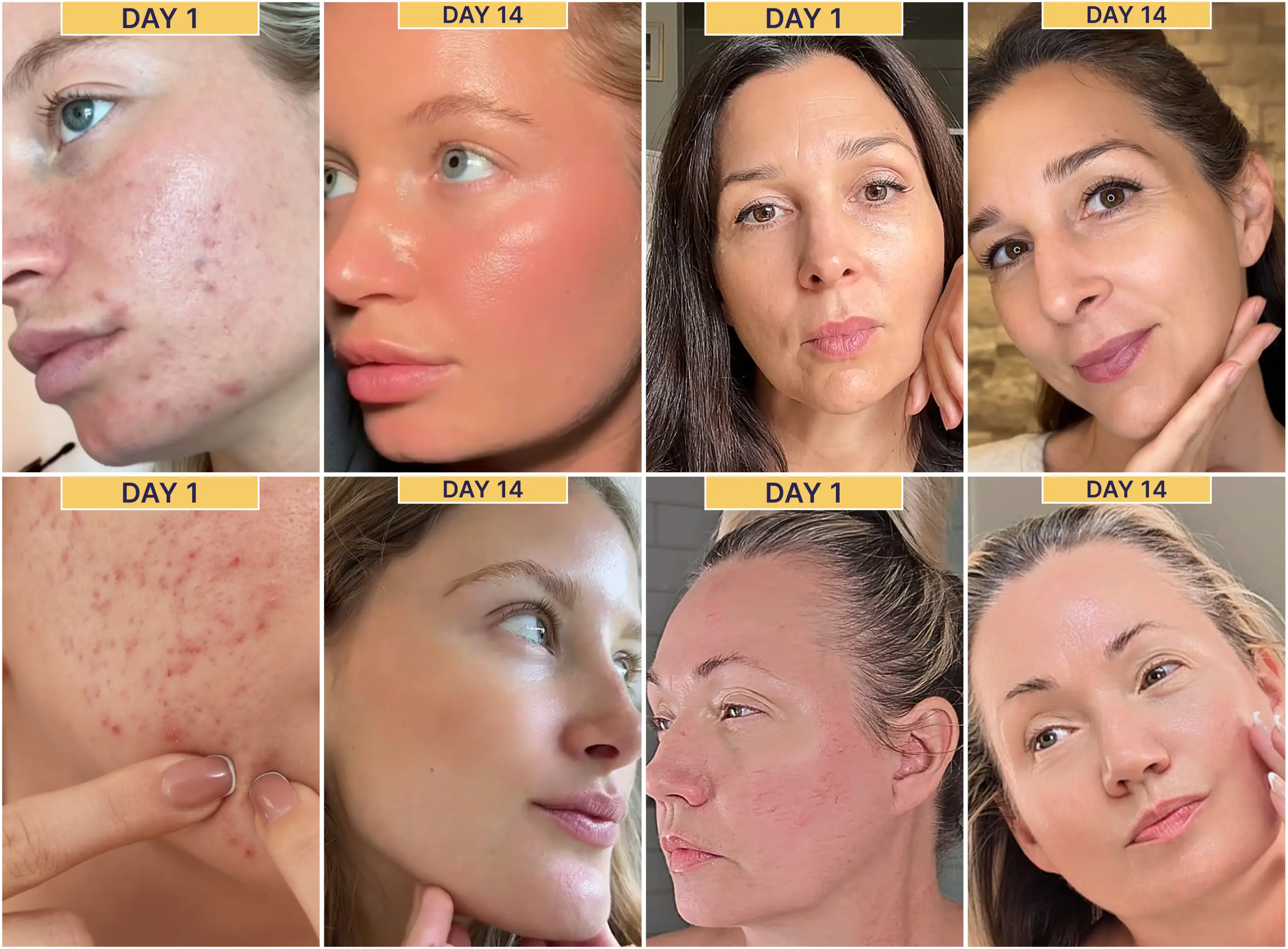 Side-by-side comparison of skincare results after Day 1 and Day 14.