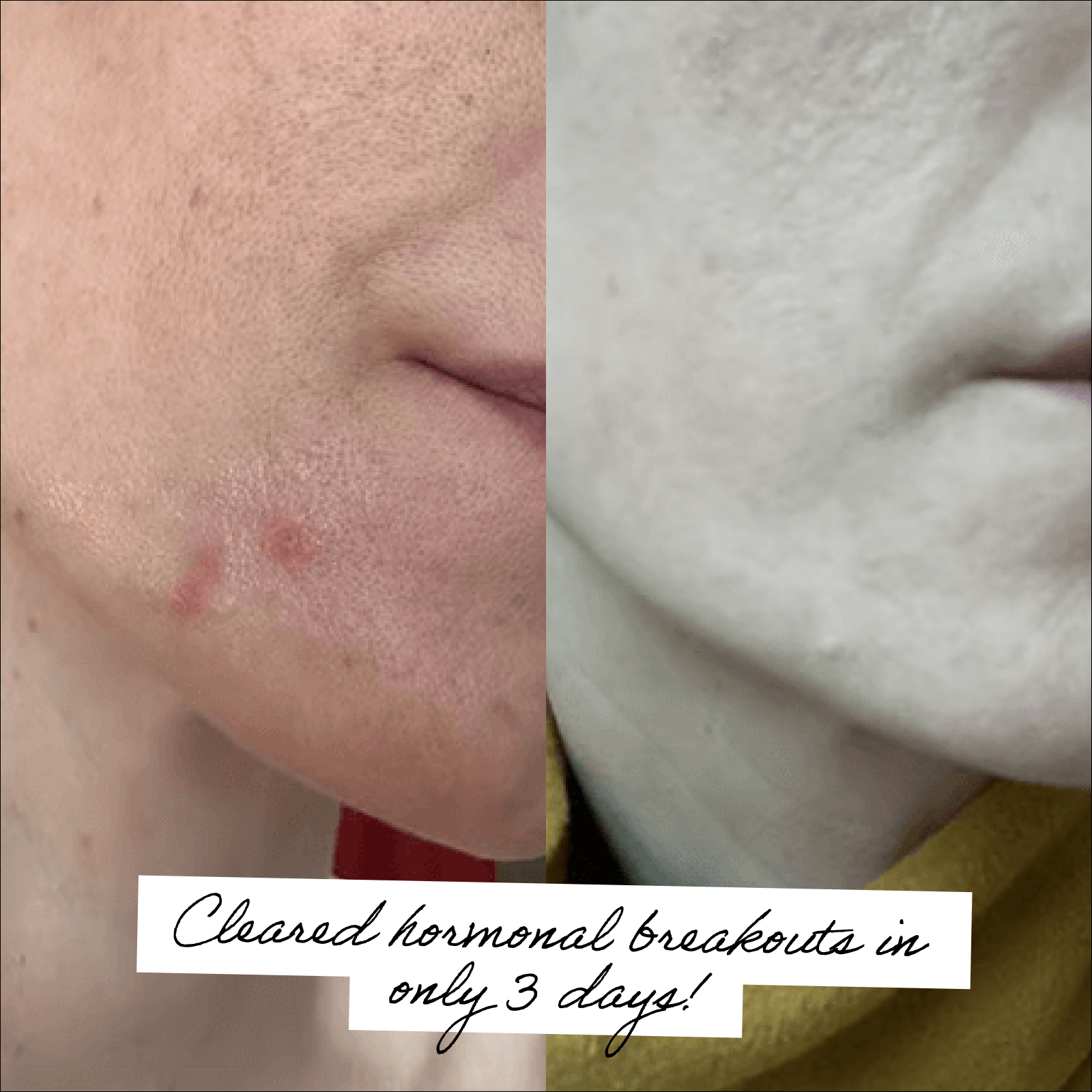 Side-by-side comparison of skin before and after treatment.