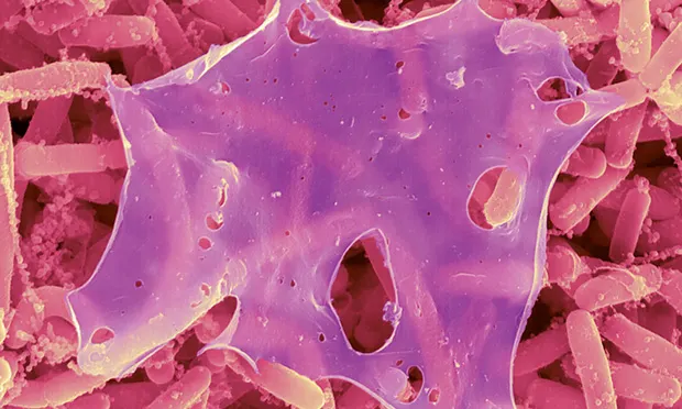 A colorized micrograph of pink, rod-shaped bacteria being covered by a thin, web-like purple substance.