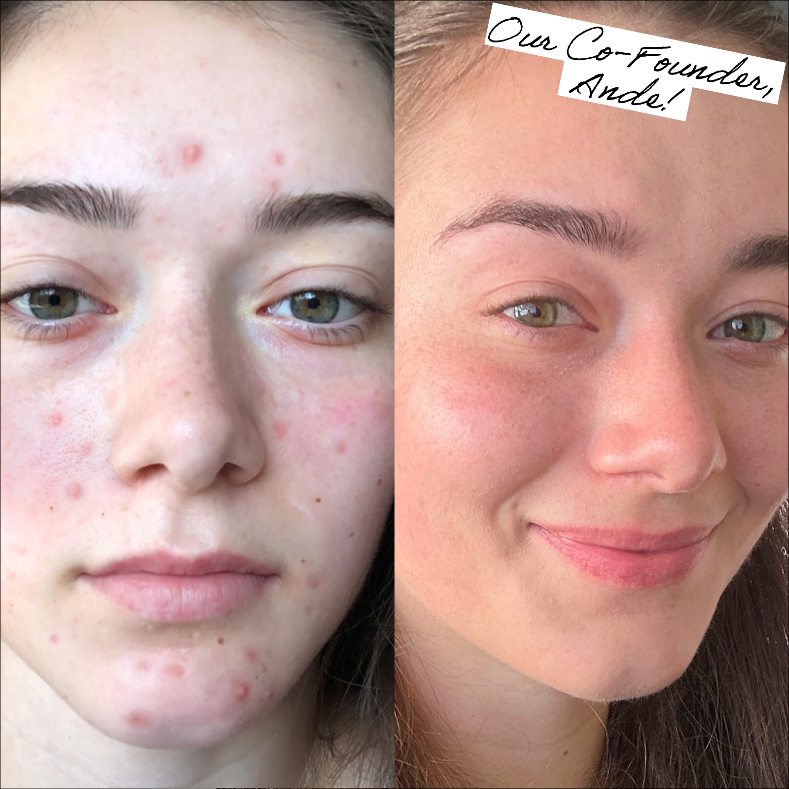 Side-by-side comparison of a woman's face before and after skincare treatment.