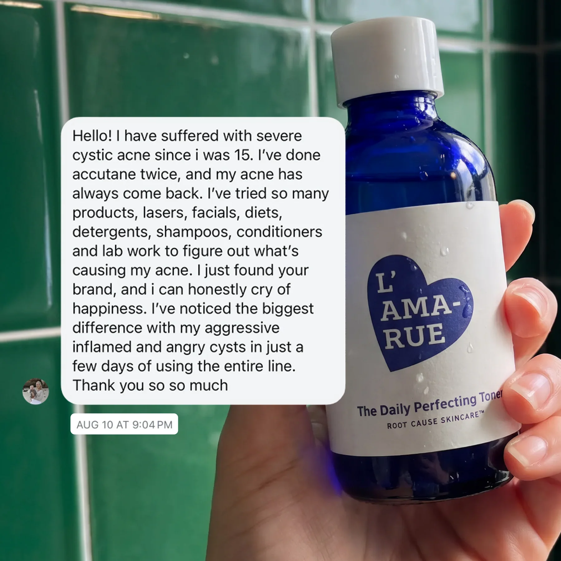 A hand holds a blue bottle of L'AMA-RUE toner next to a glowing customer review.