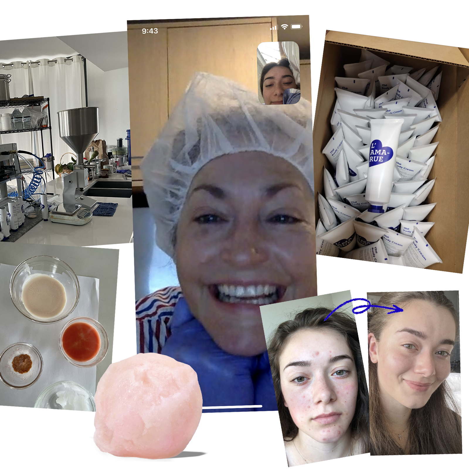 Collage of skincare products, a smiling woman, and before-and-after skin photos.