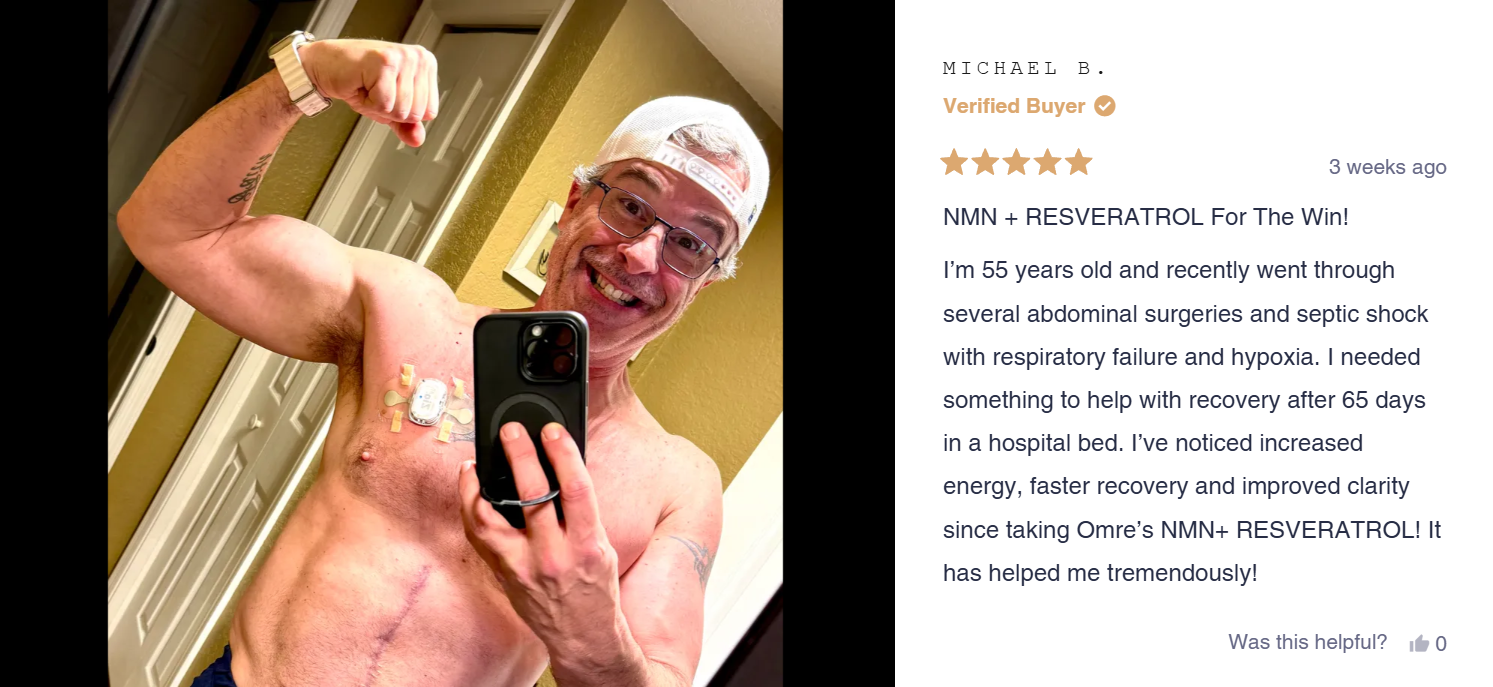 Man flexing arm in mirror selfie, wearing a cap and glasses.