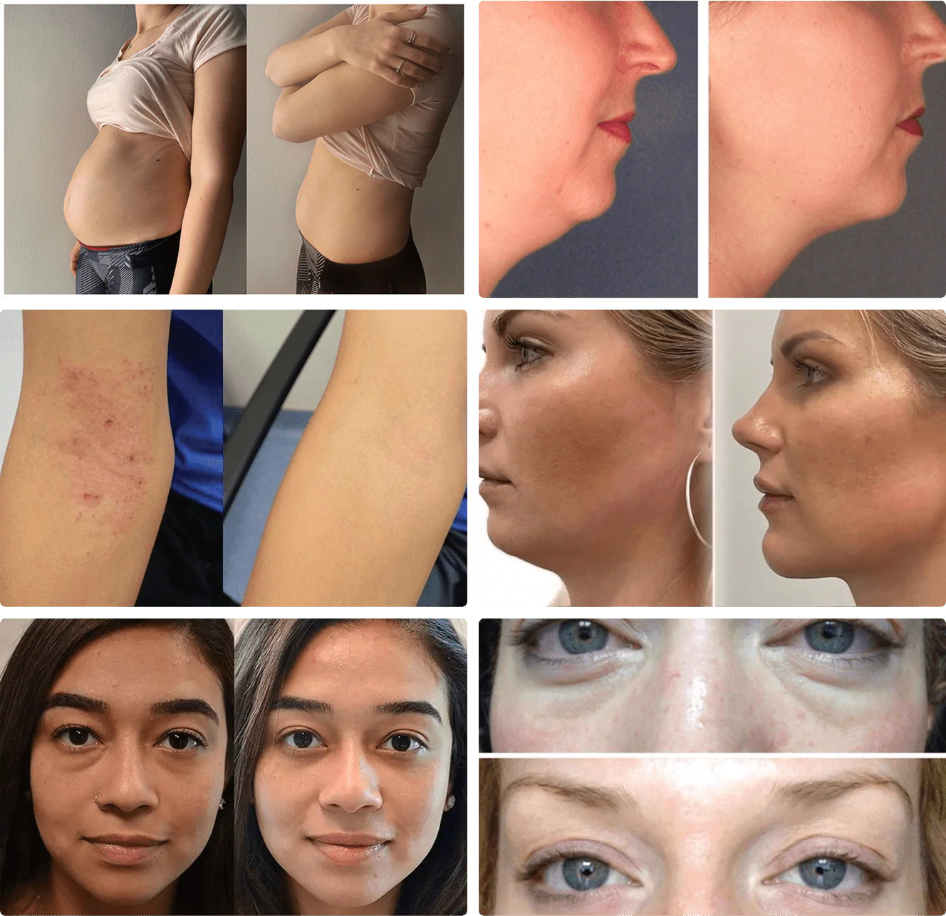 A collage of six before-and-after photos showing changes to people's skin, faces, and bodies.
