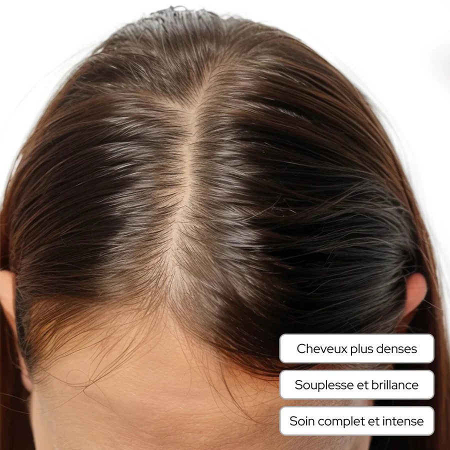A close-up of a woman's scalp, showing her dark brown hair parted in the center, with French text.