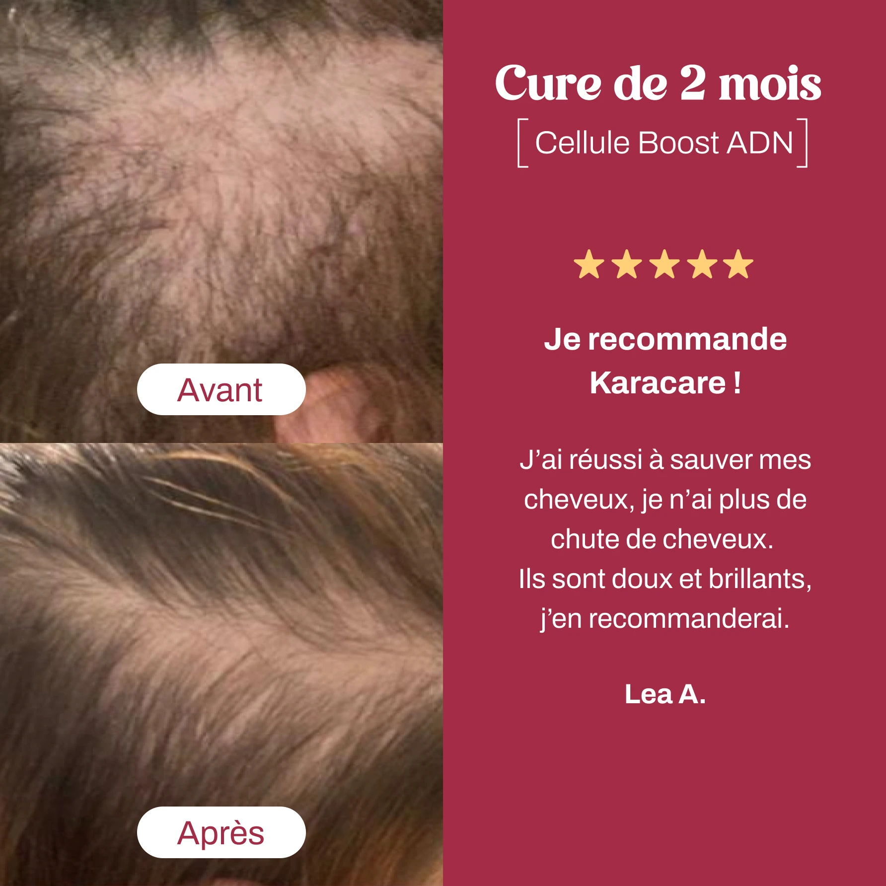 Cure Hair Boost + Cellule Boost - Karacare