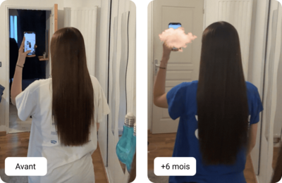 Comparison of hair condition before and after one month of treatment.