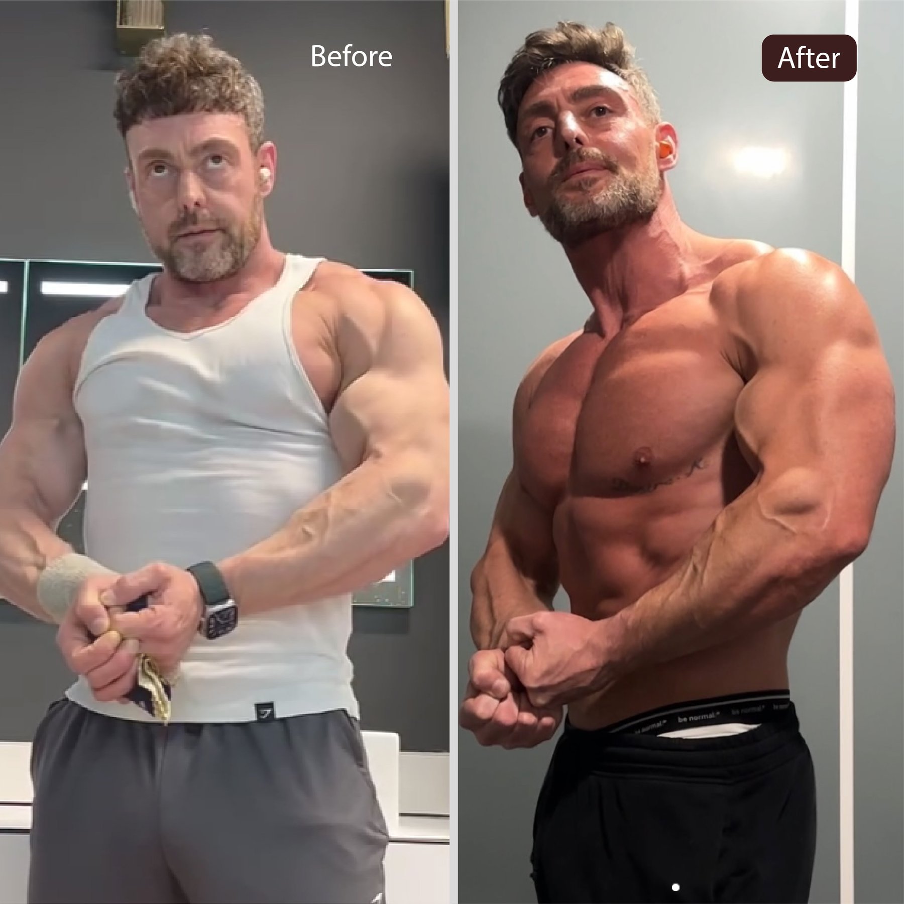 Before and after skin tone improvement
