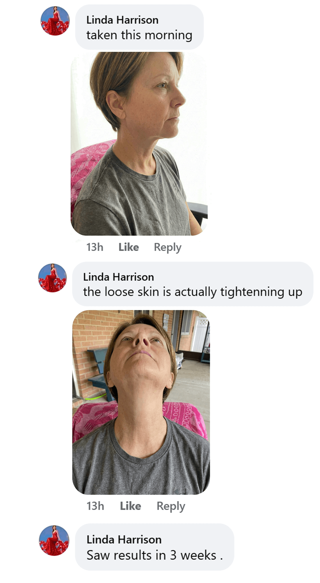 Two photos of a person seated outdoors, one looking up and one in profile.