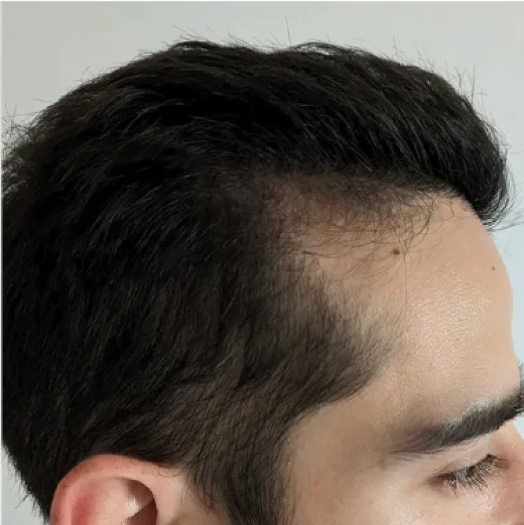 Close-up of a person's side profile showing ear and hair.
