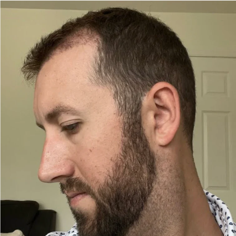 Side profile of a bearded man looking down indoors.