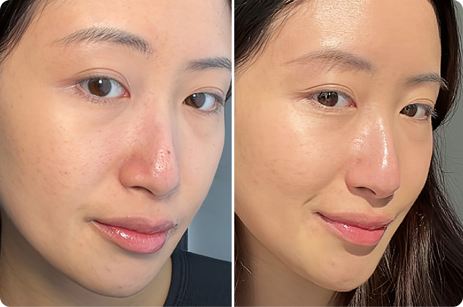 A before and after image showing a woman's facial skin looking clearer and more radiant on the right.
