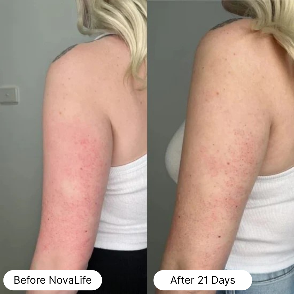Comparison of arm skin condition before and after treatment over 21 days.