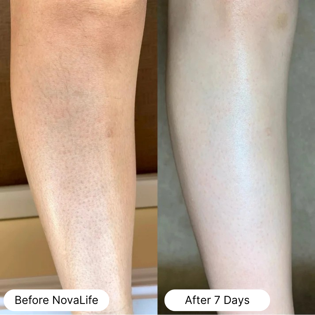 Side-by-side comparison of a leg before and after applying NovaLife product.