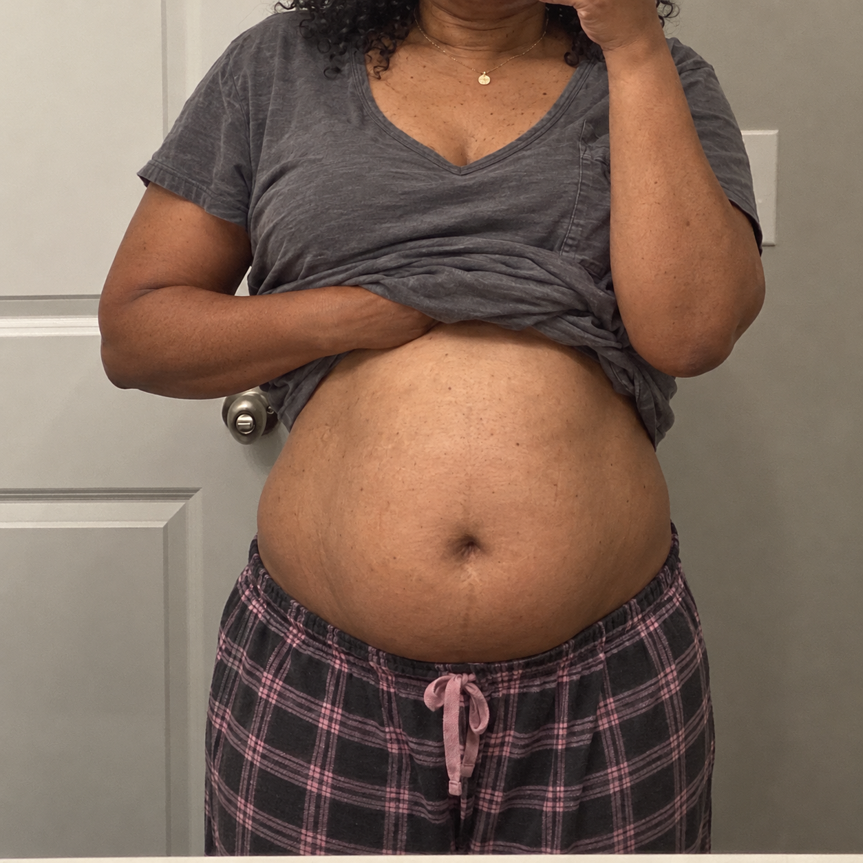 A person in plaid pajama pants lifts their grey t-shirt to show their stomach.