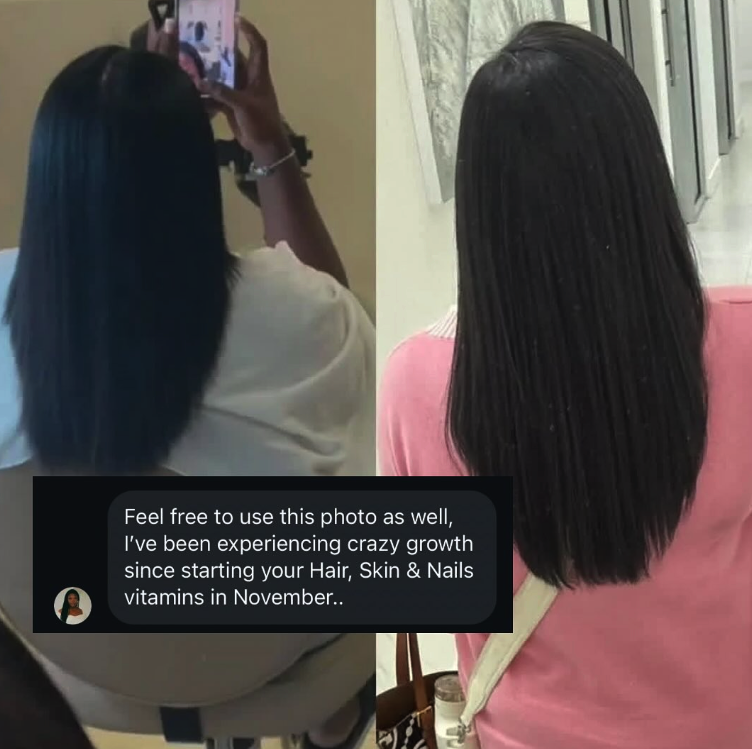 A side-by-side comparison showing a woman's hair growth, with a customer testimonial overlaid at the bottom.