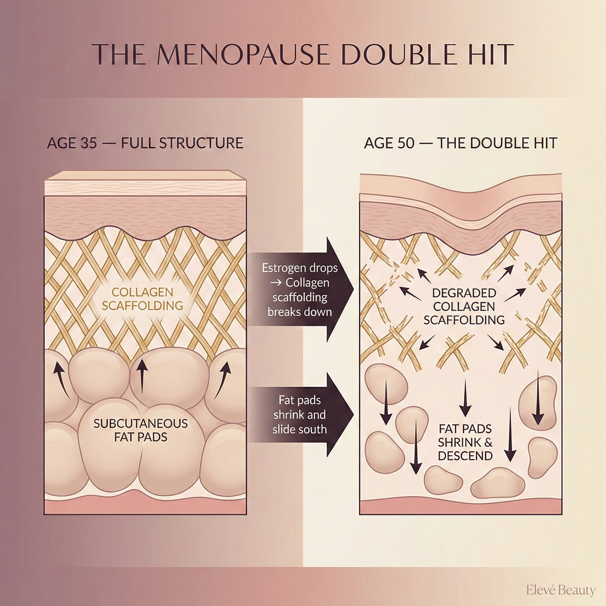 An infographic comparing skin structure at age 35 and 50, showing the effects of menopause on collagen and fat.