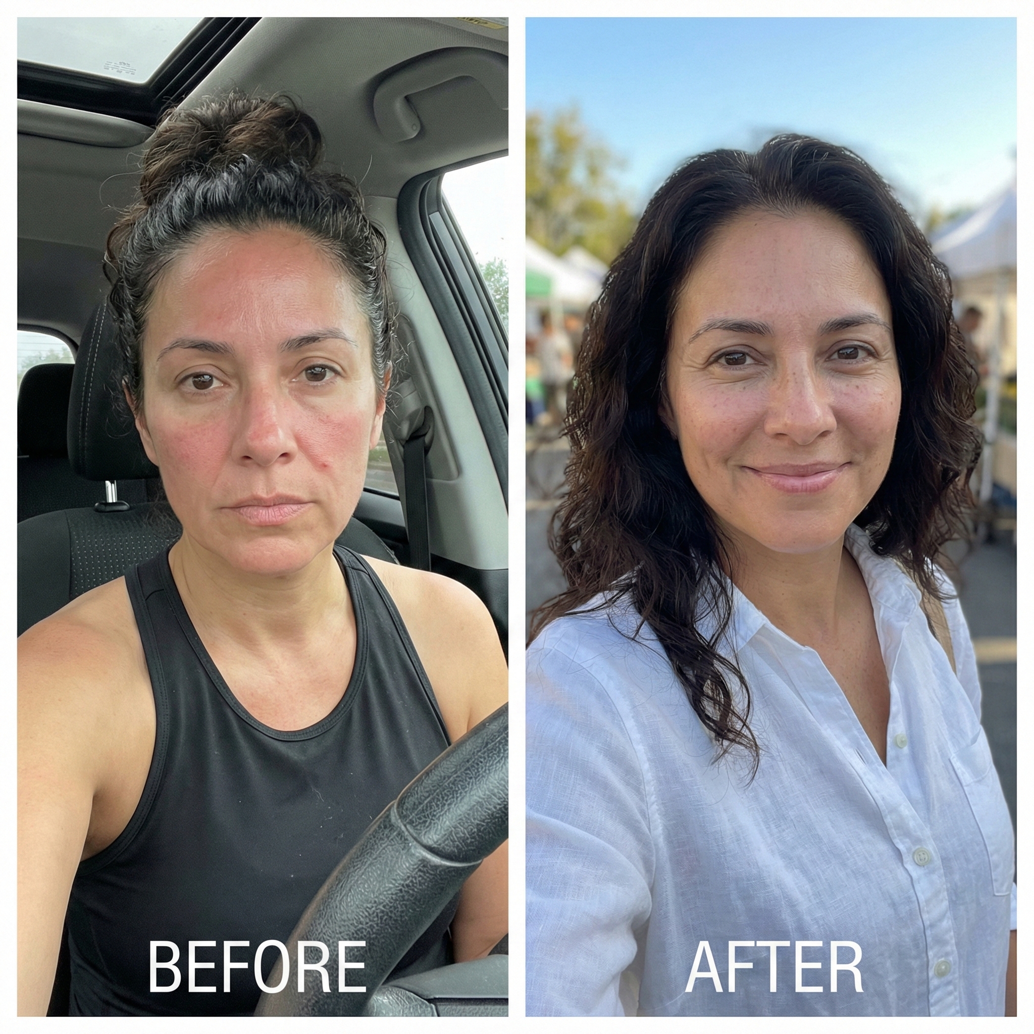 A before-and-after image showing a woman's face, with reduced redness and improved complexion in the after photo.