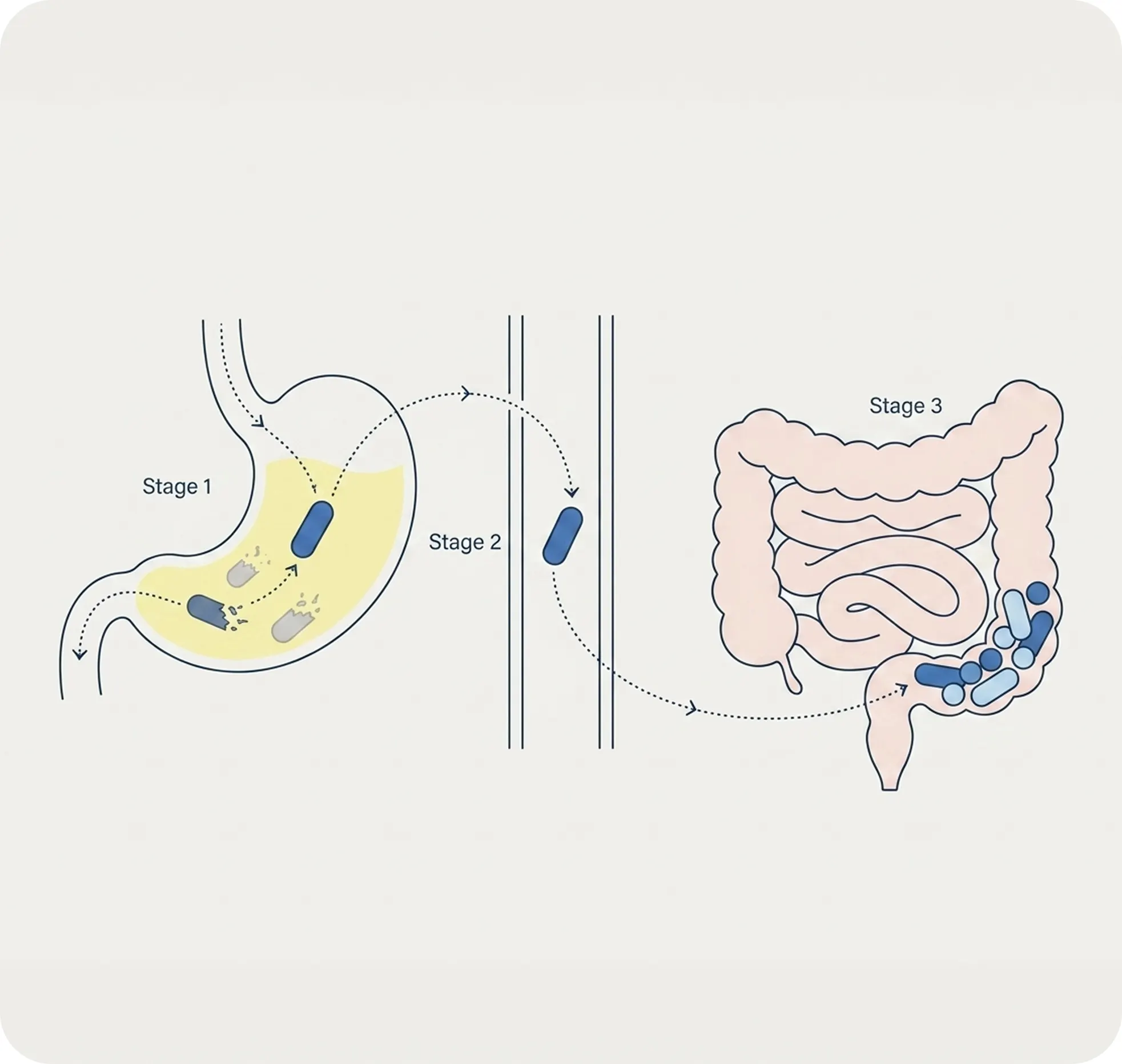 An illustration showing a capsule's journey through the stomach and large intestine in three stages.