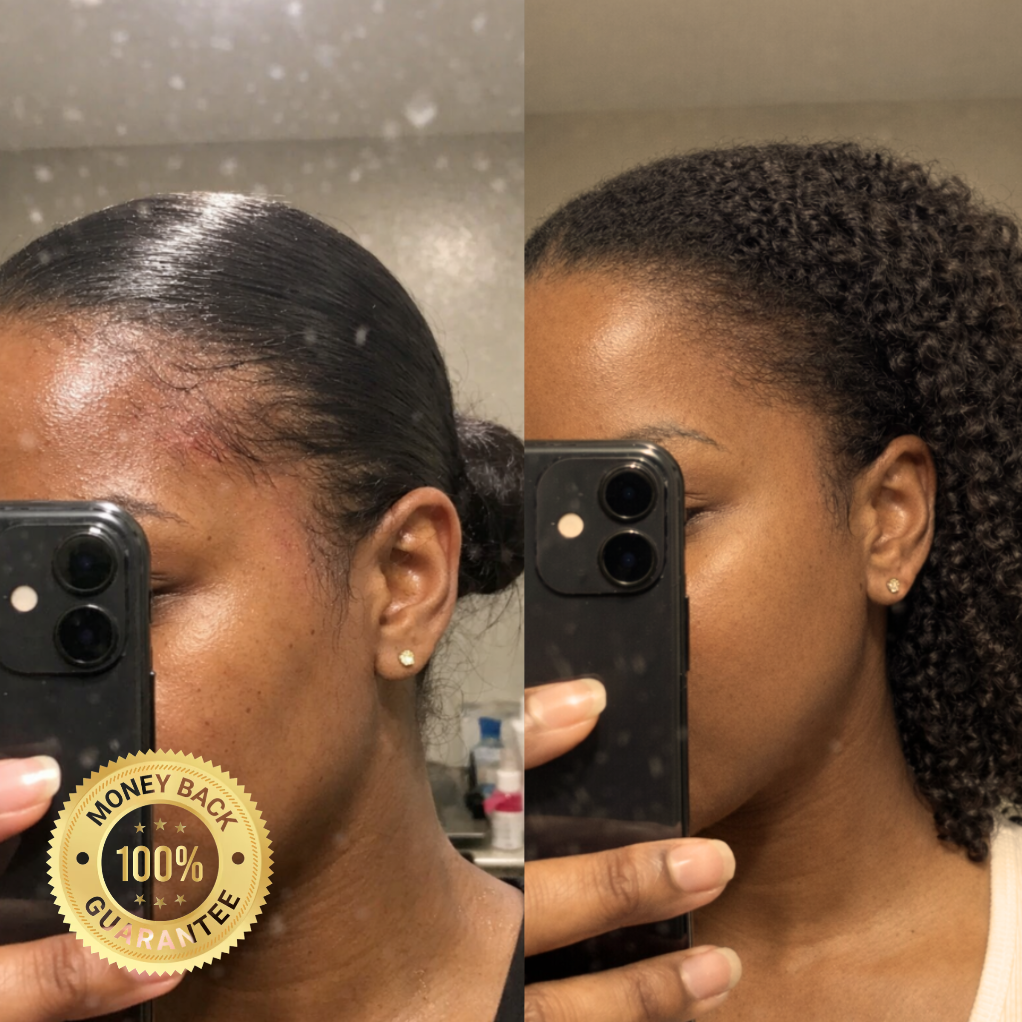 A before and after comparison showing a woman's hairline appearing fuller and less irritated.