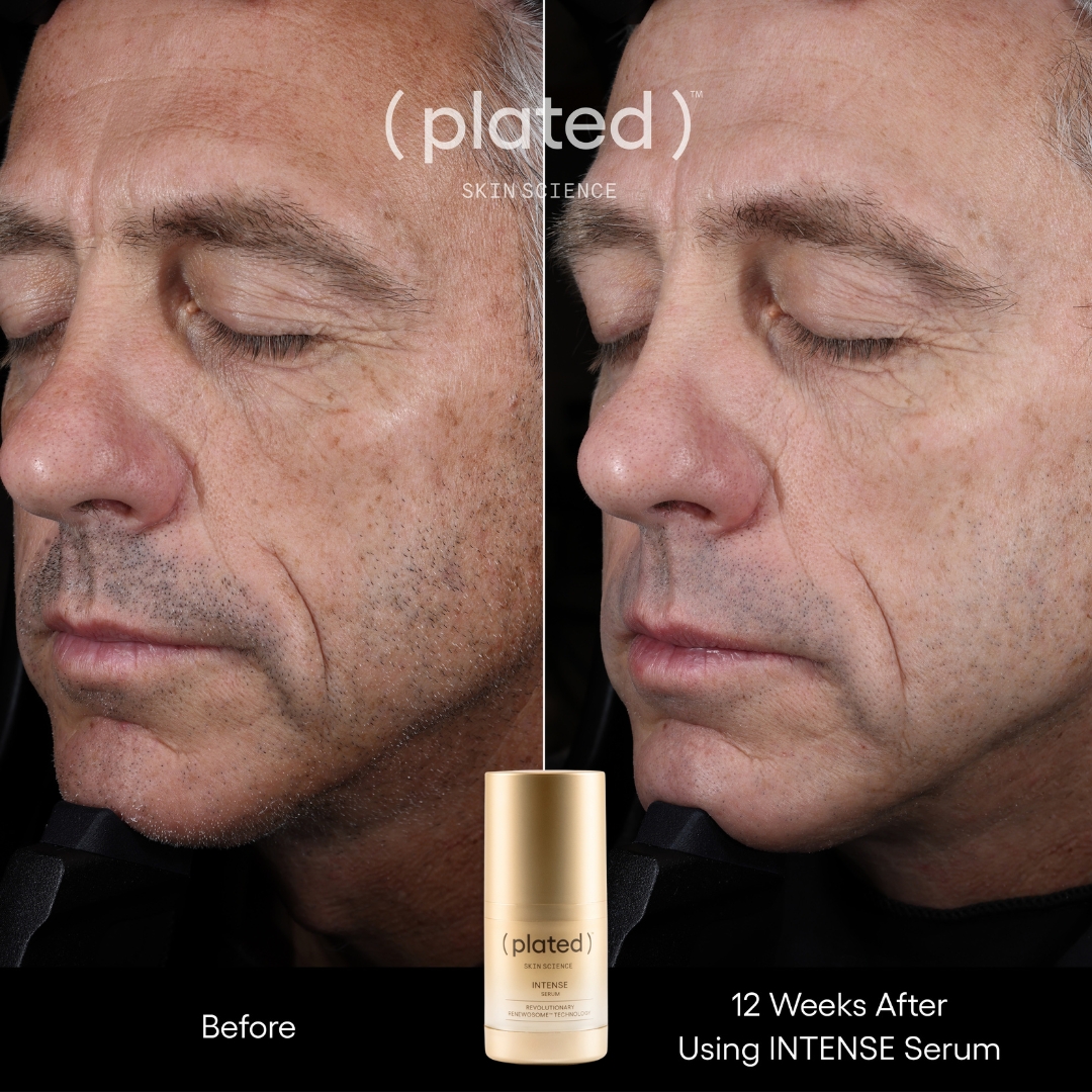 A split image showing a man's face before and after 12 weeks of using Plated Intense Serum.