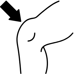 Line drawing of a knee joint with an arrow pointing to it.