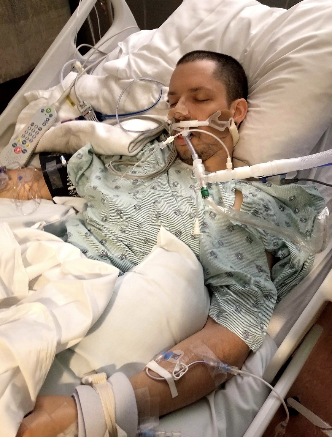 Person lying in a hospital bed with medical tubes and devices.