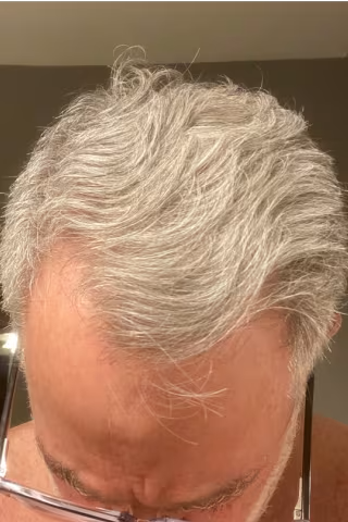 Close-up of a person with gray hair looking down.