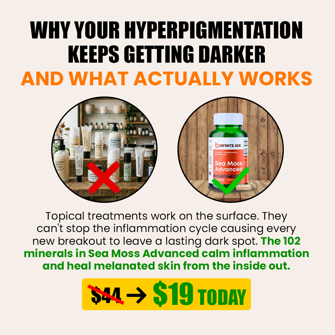 Advertisement for a hyperpigmentation supplement, comparing it to topical creams and showing a sale price.