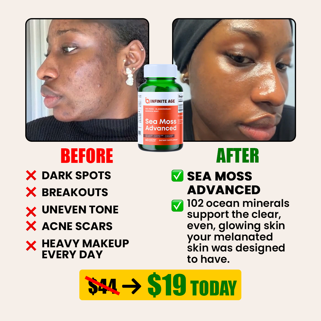 An advertisement showing before and after photos of a woman's skin with a bottle of Sea Moss Advanced.
