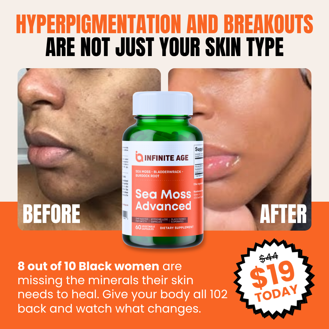 An advertisement for Sea Moss Advanced supplement, showing before and after photos of a woman's skin.