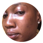 A close-up, circular-cropped photo of a Black woman with glowing skin looking towards the camera.