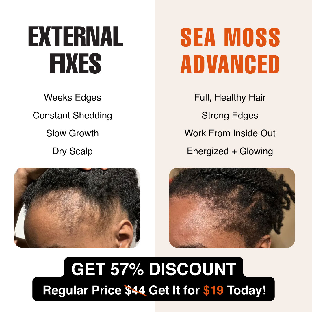 An ad with before-and-after photos showing hair growth along a person's hairline, promoting a Sea Moss product.