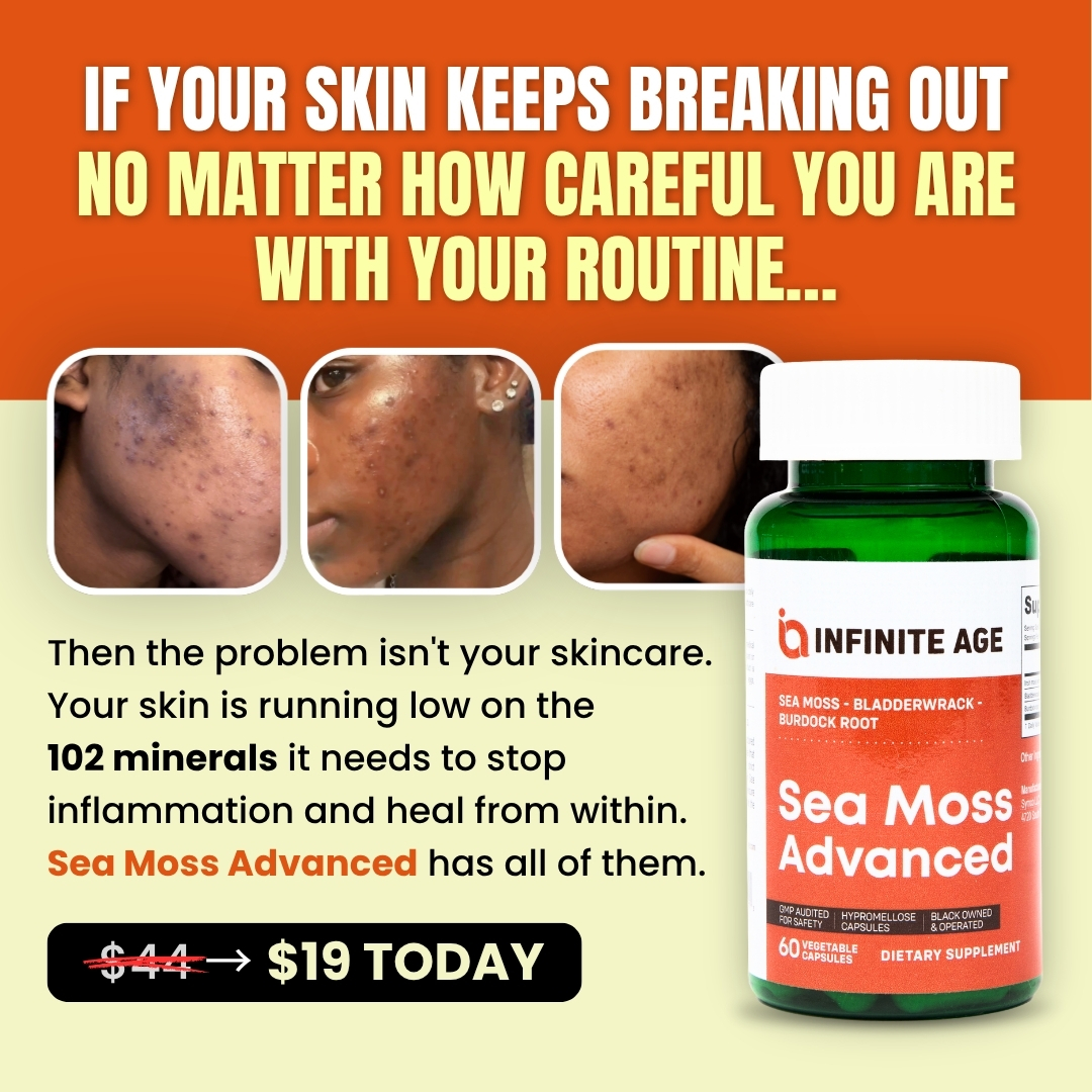 An advertisement for Infinite Age Sea Moss Advanced supplement, showing faces with acne next to the product bottle.