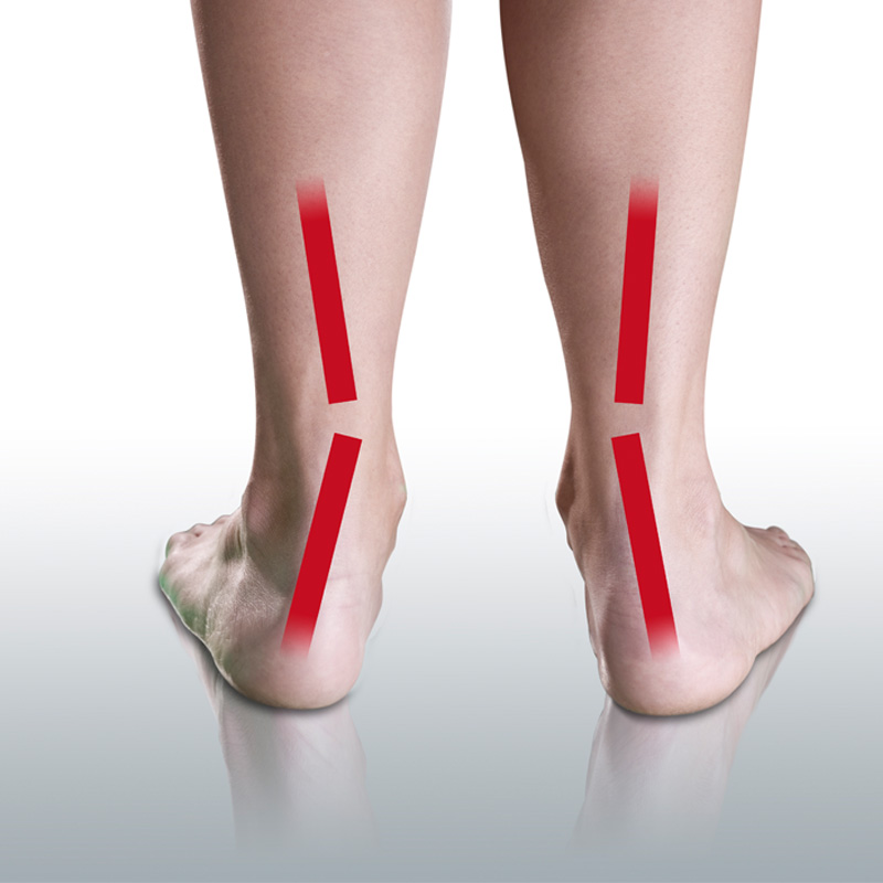 Back view of feet with red lines indicating alignment.