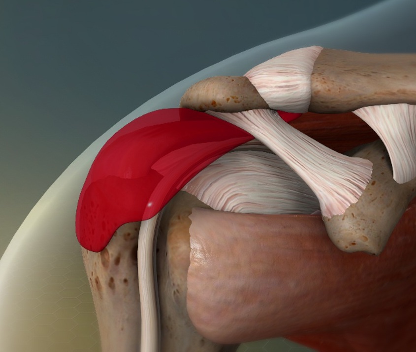 Illustration of shoulder joint anatomy with muscles and tendons.