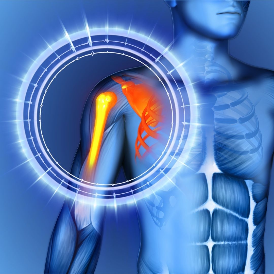 Illustration of the human shoulder joint highlighted in orange on an anatomical model.