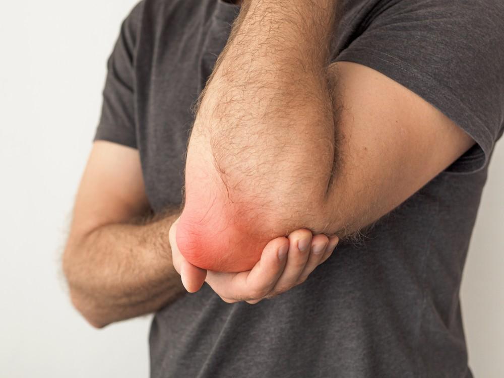 Person holding a swollen, red elbow with one hand.