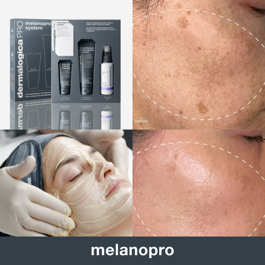 Collage of skincare products, facial treatment, and skin close-ups labeled 'before' and 'after.'