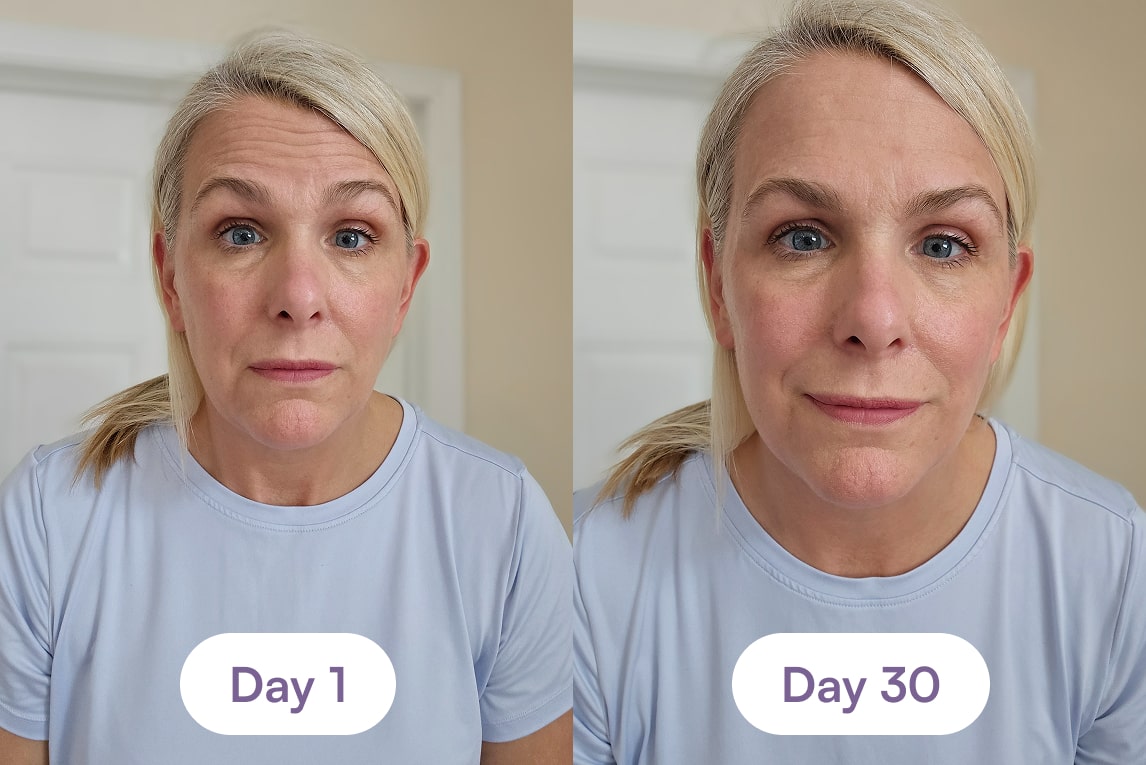 Side-by-side images of the same woman labeled 'Day 1' and 'Day 30'.