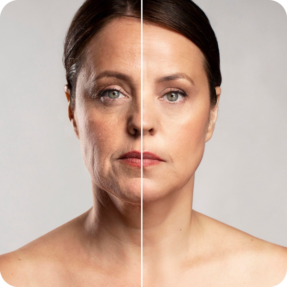 Split image of a woman's face showing aging on one side.
