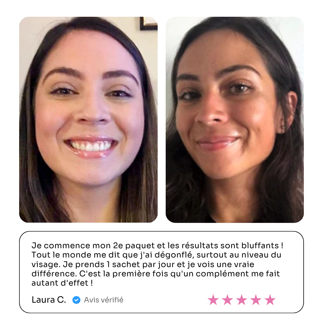 A customer testimonial with before-and-after photos of a woman's face, showing a visible change in facial definition.