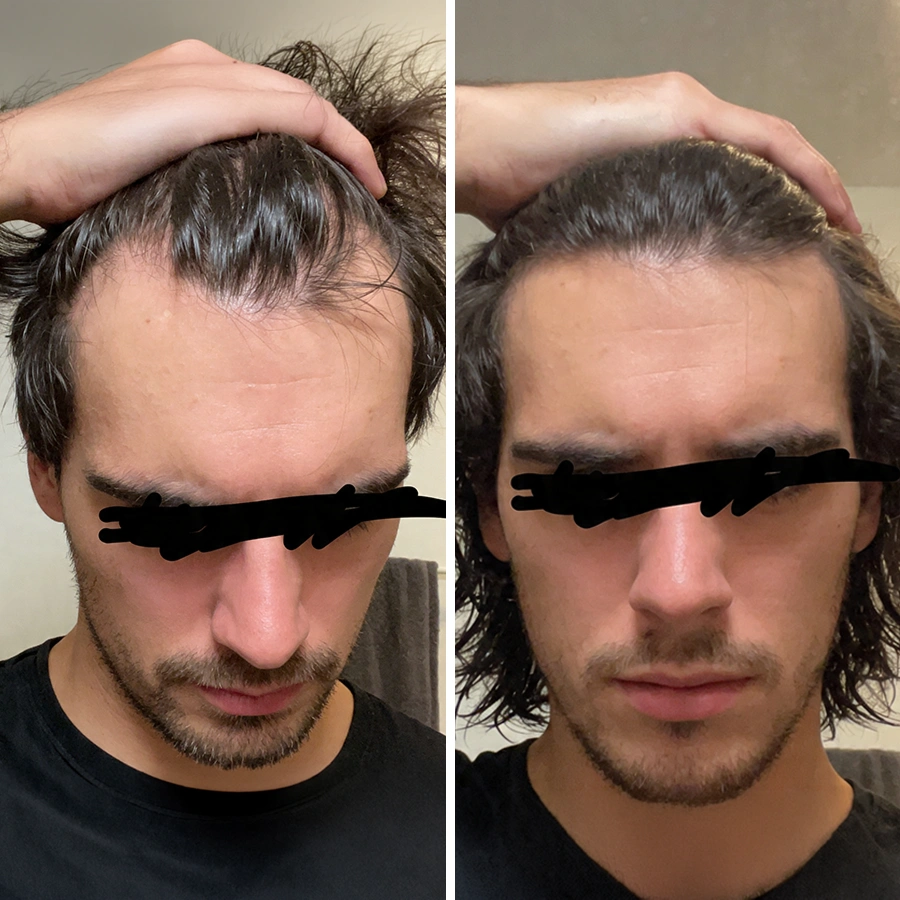 Romain - avant/après