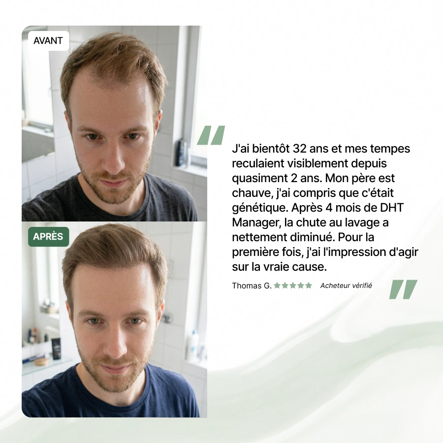 Before and after photos showing a man's hair regrowth, with a fuller hairline in the after picture.