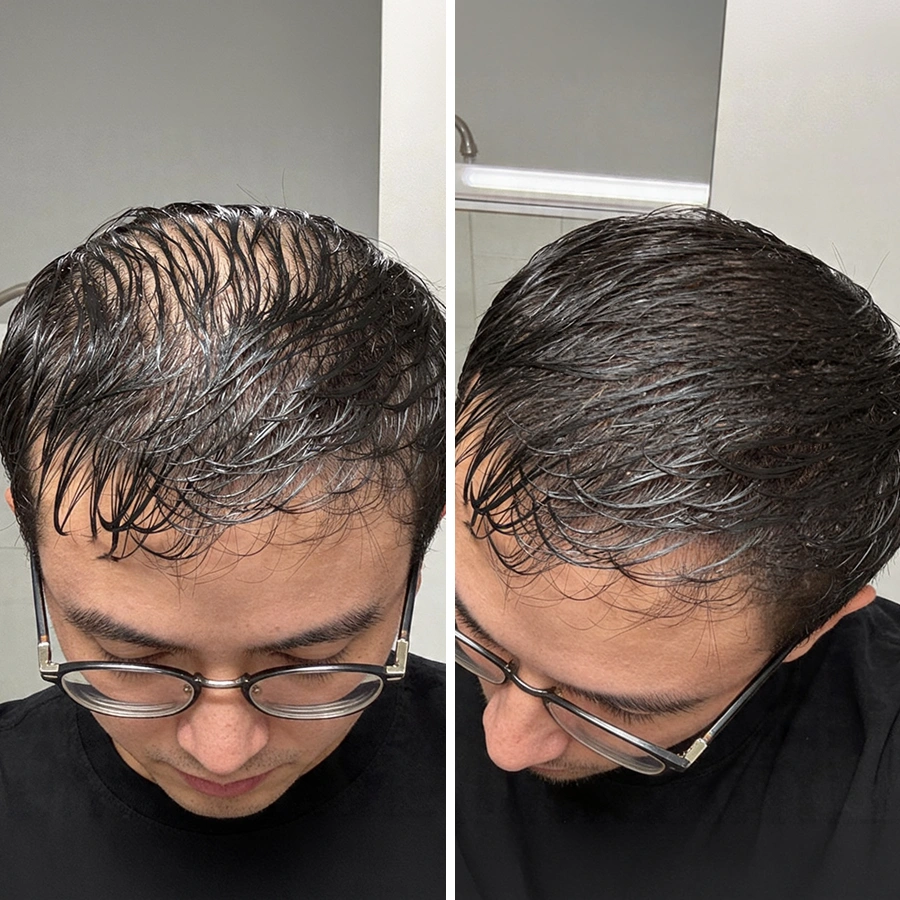 Julien - avant/après