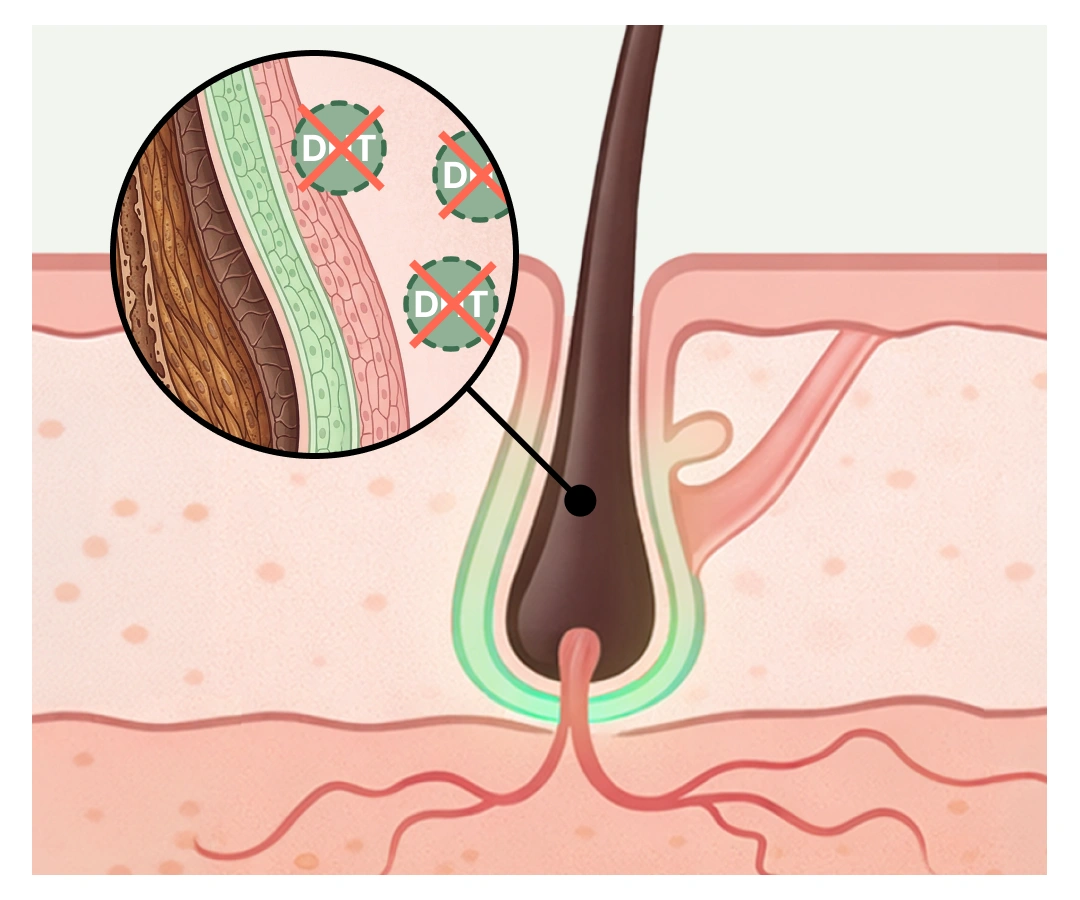 DHT Manager coupe le circuit à la source