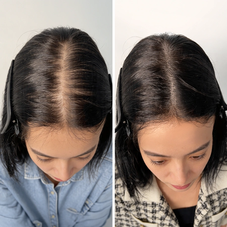 Camille - avant/après