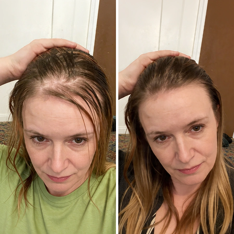 Martine - avant/après